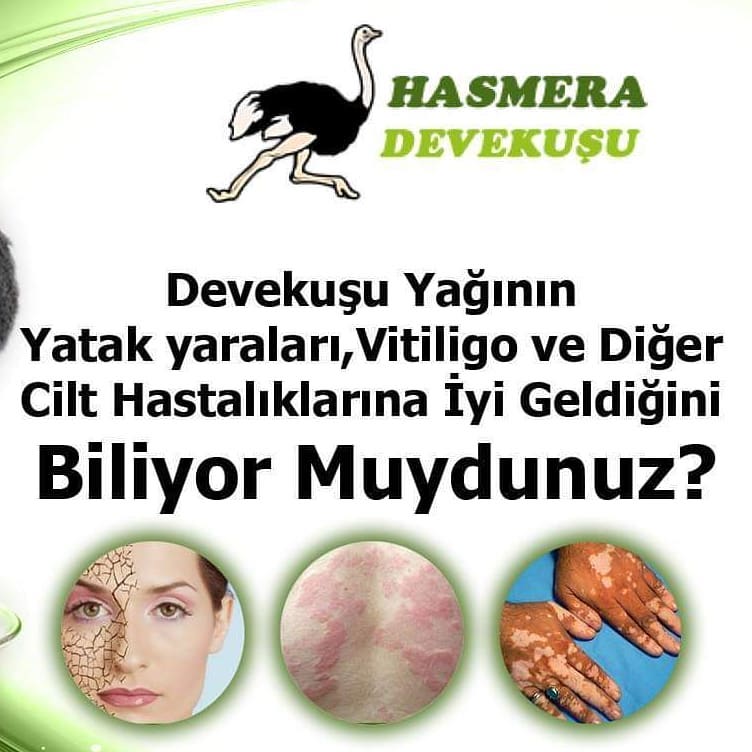 Toptan%20Devekuşu%20Yağı